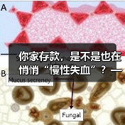 你家存款，是不是也在悄悄“慢性失血”？——聊聊家庭投资理财那 - 玄熵一站式工程设备租赁